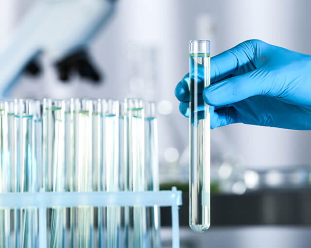 Controllo Acqua Potabile: Ogni quanto va fatto?